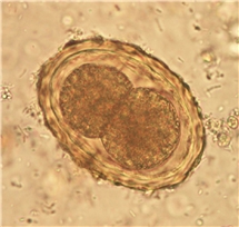 Bild på Ascaris (spolmask), ägg.