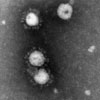 Mikroskopbild på Coronovirus (sars).