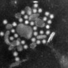 Mikroskopbild på norovirus (vinterkräksjuka).